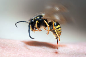 Venom Immunotherapy For Stinging Insect Allergy